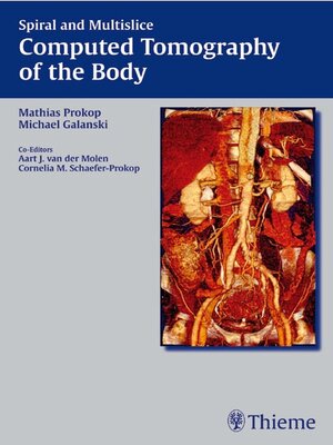 cover image of Spiral and Multislice Computed Tomography of the Body